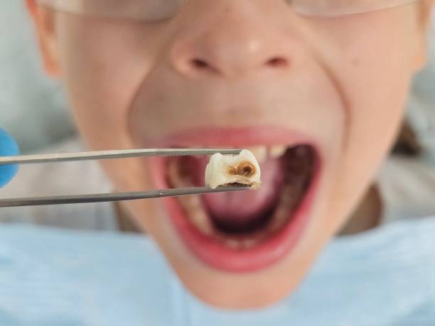 Best Cosmetic Emergency Dentistry in Brushy, OK